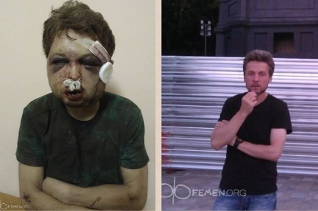 Un des membre de FEMEN, Viktor Svyatskiy, brutalement battu par les services secrets de la police ukrainienne