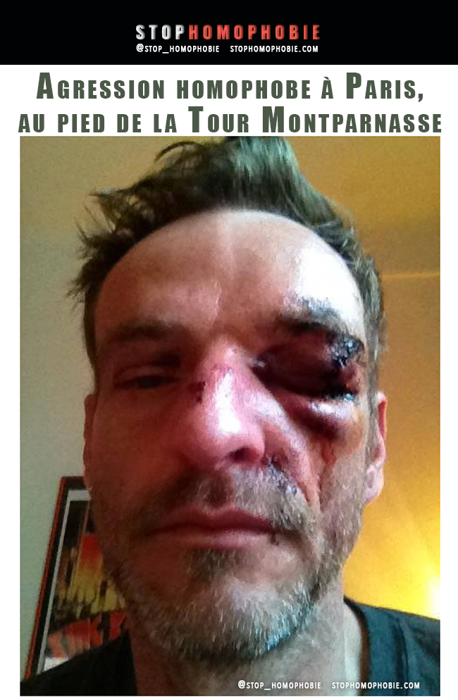 Justice : SOS homophobie partie civile suite à l'agression homophobe de la gare Montparnasse