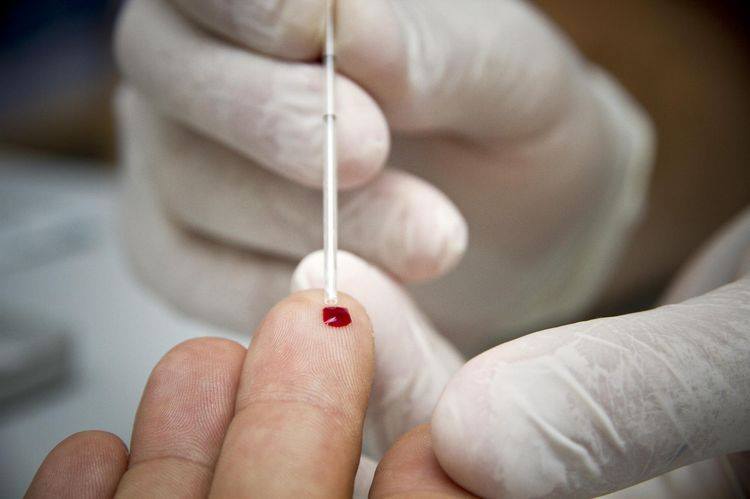 VIH : Le nombre de décès liés au sida continue à progresser en Russie faute de prévention