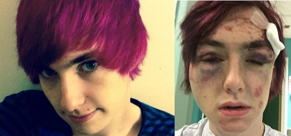Royaume-Uni : Deux jeunes homosexuels roués de coups par des individus en "tutus roses"