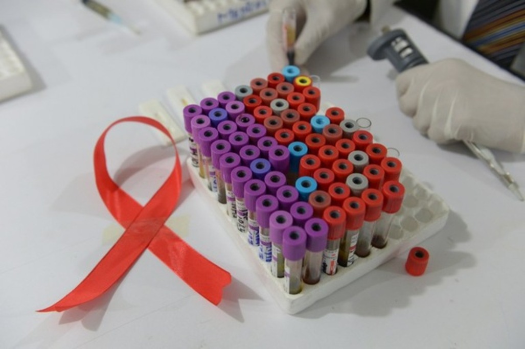 Santé : Un traitement préventif anti-sida testé pour la première fois en Belgique