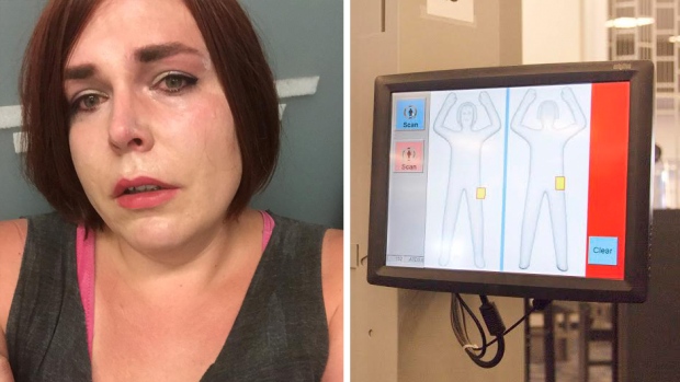 Une femme transgenre arrêtée à l'aéroport pour « son anomalie » sur le scanner