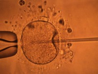 Procréation médicalement assistée : Bientôt davantage de donneurs d’ovocytes et de sperme