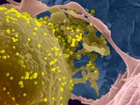 VIH/Sida : découverte d'anticorps « performants » capables de repérer et détruire les réservoirs infectées