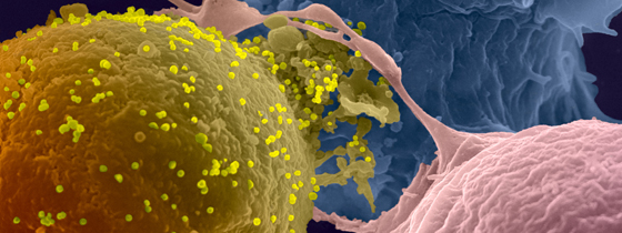 VIH/Sida : découverte d'anticorps « performants » capables de repérer et détruire les réservoirs infectées
