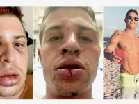 Violente agression d'un couple homosexuel dans un Burger King de Miami en Floride (VIDEOS)