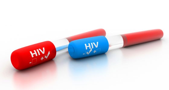 VIH/Etude : les antirétroviraux réduisent le risque de transmission du virus au sein du couple