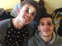 Agression homophobe à la sortie d'un club de Milan : « Traumatisme crânien, fracture du nez... »