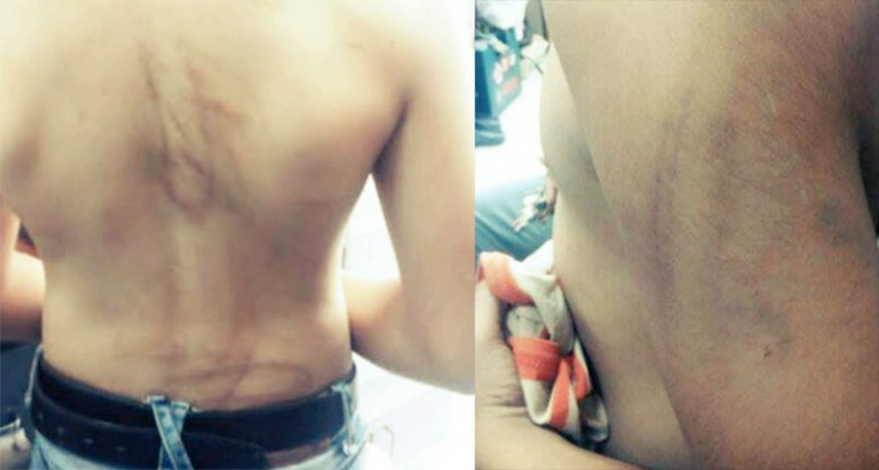 En Tunisie, un adolescent gay de 17 ans « séquestré » et violenté par son père « à coups de tuyau à gaz »