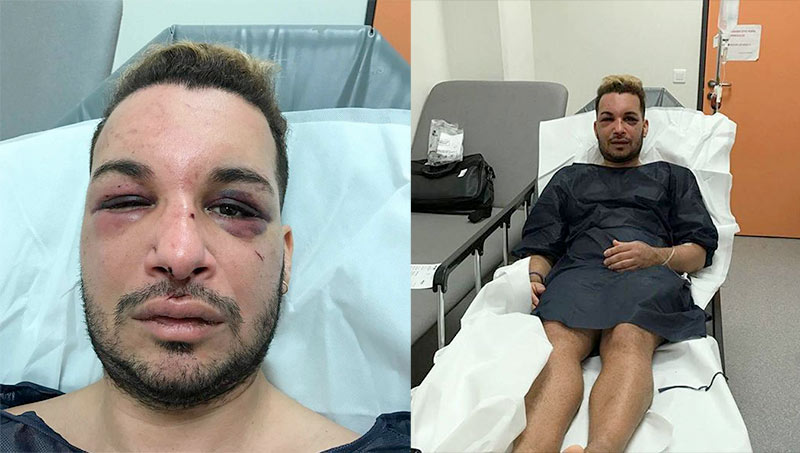 Un militant LGBT « séquestré et sauvagement agressé » pendant plus de 48 heures à Marseille