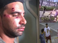 Miami Beach : un couple gay tabassé par 4 jeunes hommes après le défilé de la Pride (VIDEOS)