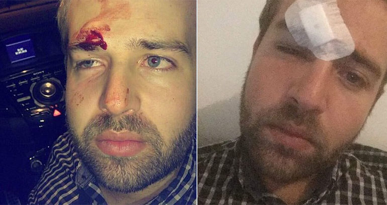 Deux étudiants victimes d'une agression homophobe à Nantes : « Fin de nuit aux urgences avec trois points de sutures »