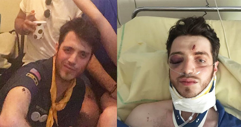Agression d'un jeune gay place de La République à Paris : la victime hospitalisée