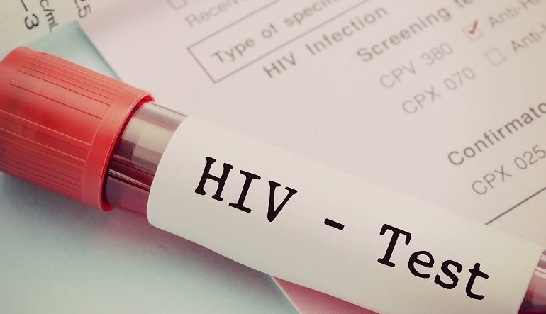 Royaume-Uni : le nombre d’infections au VIH chute de 71% chez les hommes gays et bisexuels