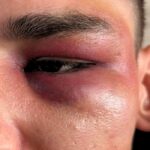 L’arbitre allemand Pascal Kaiser agressé après sa demande en mariage publique