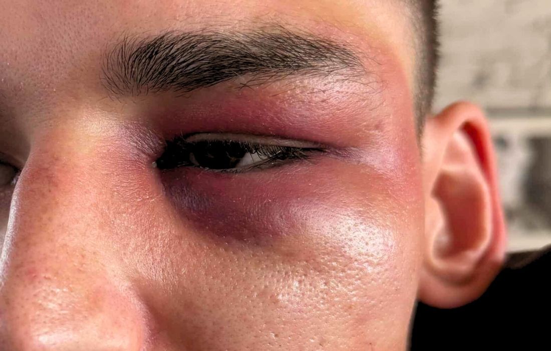 L’arbitre allemand Pascal Kaiser agressé après sa demande en mariage publique