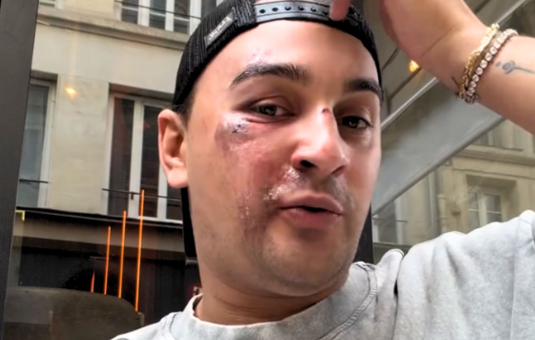 Nouvelle agression homophobe en plein 7e arrondissement à Paris