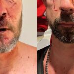 Hérault : un couple victime d’un harcèlement homophobe et de violences sur fond de conflit de voisinage