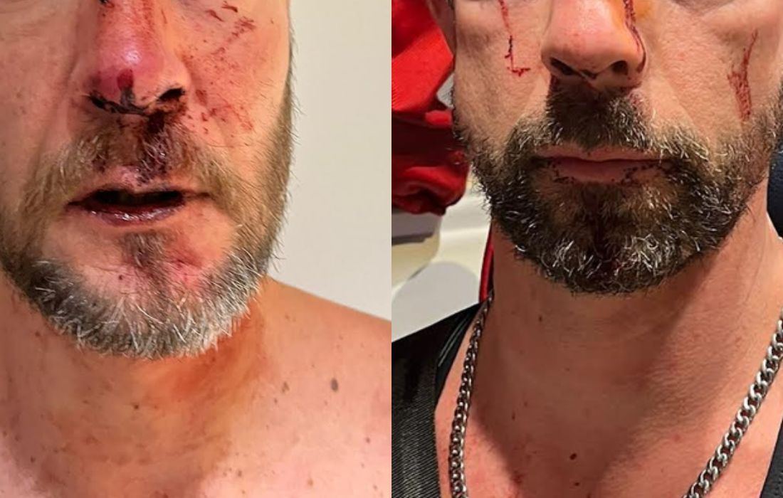 Hérault : un couple victime d’un harcèlement homophobe et de violences sur fond de conflit de voisinage