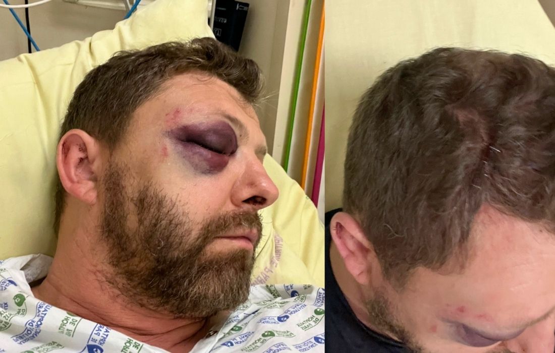 Pierre Picavet, président de FLAG!, victime d’une agression homophobe à Paris